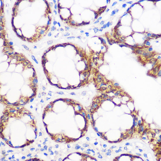 IGF2BP2/IMP2 Rabbit mAb
