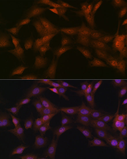 P23/PTGES3 Rabbit mAb