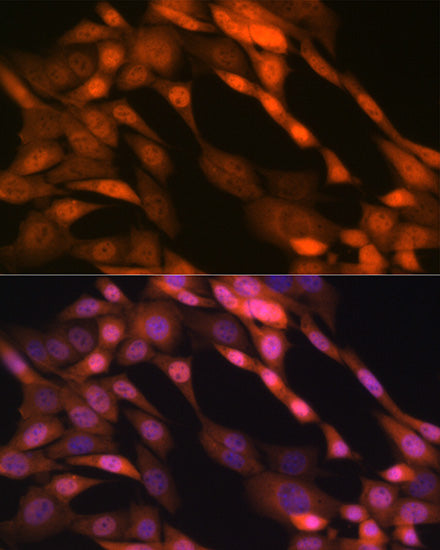 P23/PTGES3 Rabbit mAb