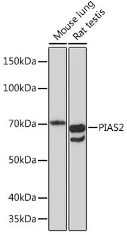 PIAS2 Rabbit mAb