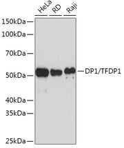 DP1/TFDP1 Rabbit mAb