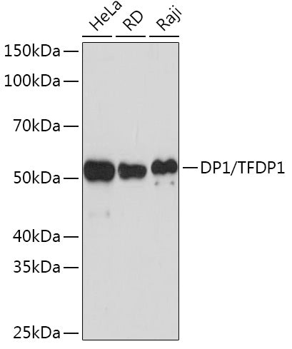 DP1/TFDP1 Rabbit mAb