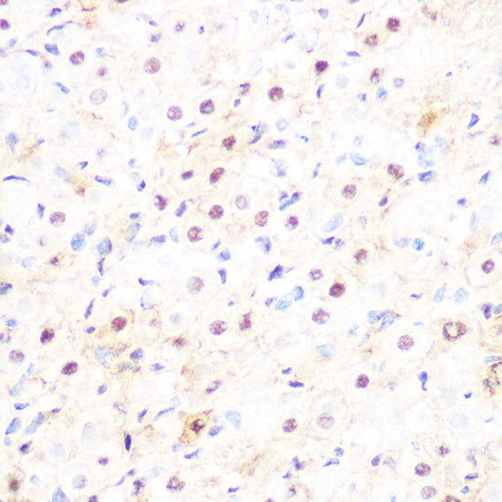 DP1/TFDP1 Rabbit mAb