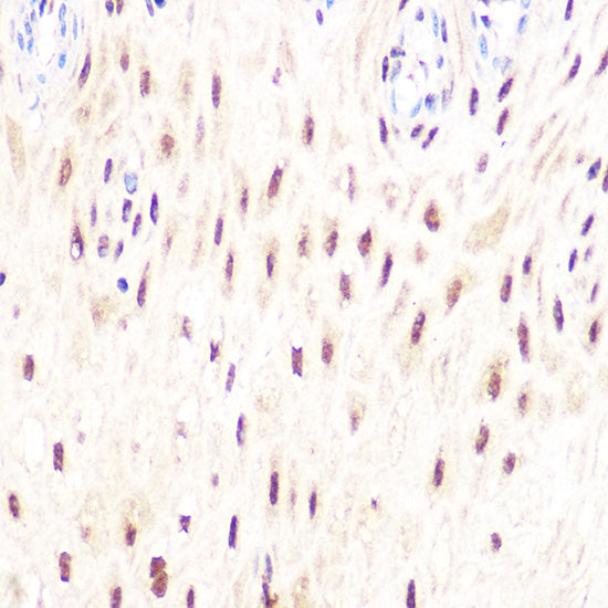 DP1/TFDP1 Rabbit mAb