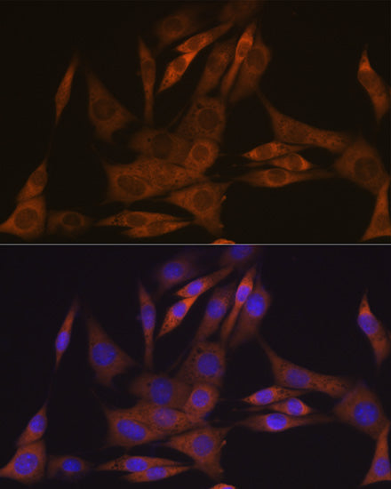 KIFAP3 Rabbit mAb