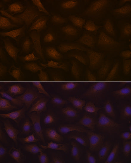 KIFAP3 Rabbit mAb