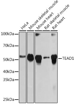 TEAD1 Rabbit mAb