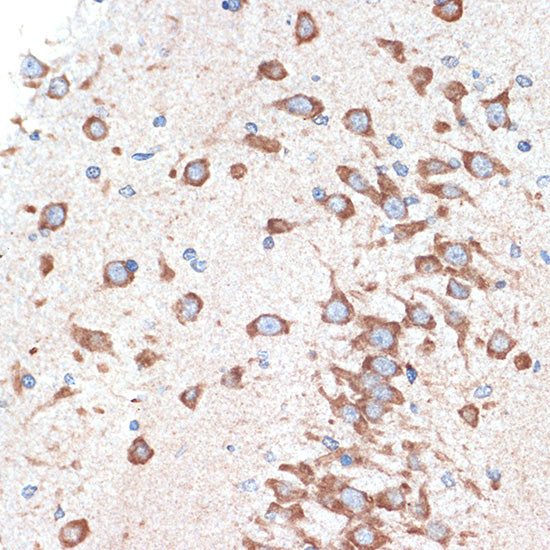 ADORA1 Rabbit mAb