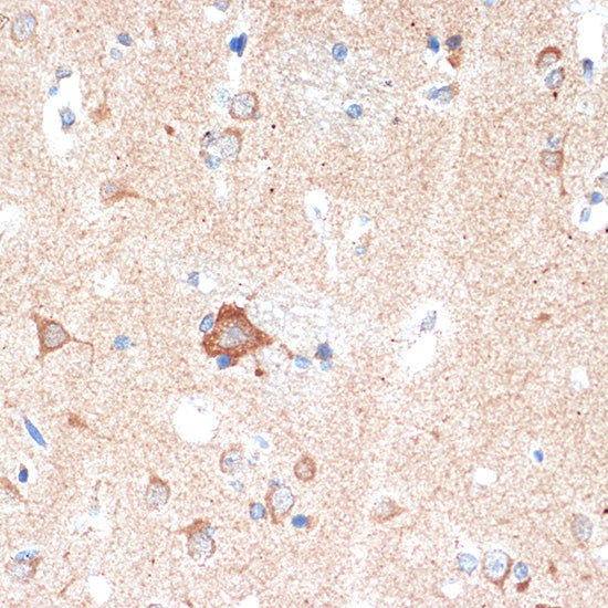 ADORA1 Rabbit mAb
