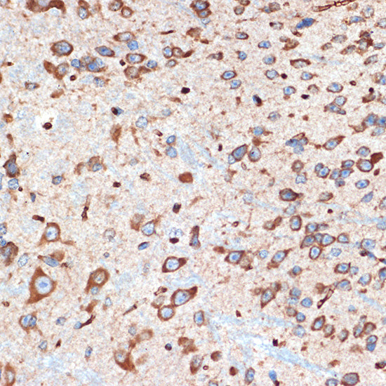 ADORA1 Rabbit mAb