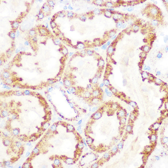 DLDH/DLD Rabbit mAb
