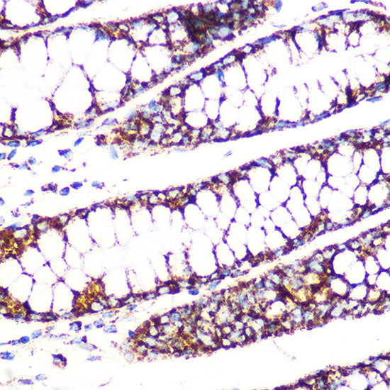 DLDH/DLD Rabbit mAb