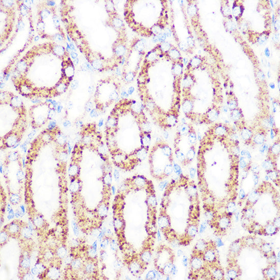 DLDH/DLD Rabbit mAb