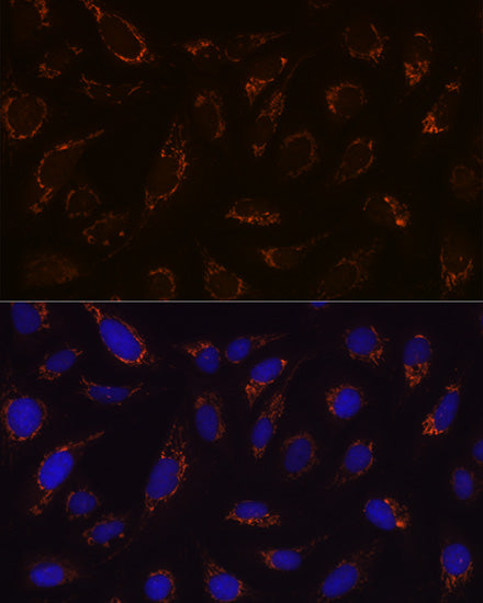 DLDH/DLD Rabbit mAb