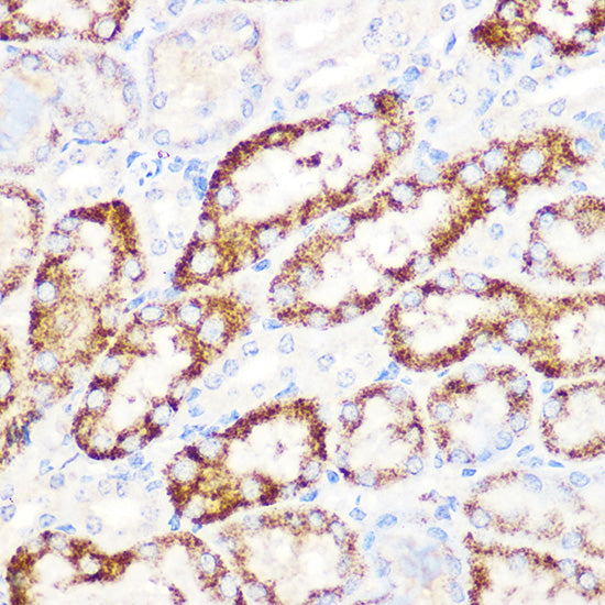 ANGPTL3 Rabbit mAb