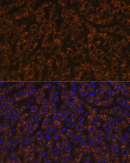 ANGPTL3 Rabbit mAb