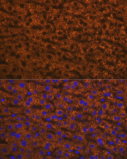 ANGPTL3 Rabbit mAb