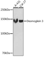 Desmoglein 3 Rabbit mAb