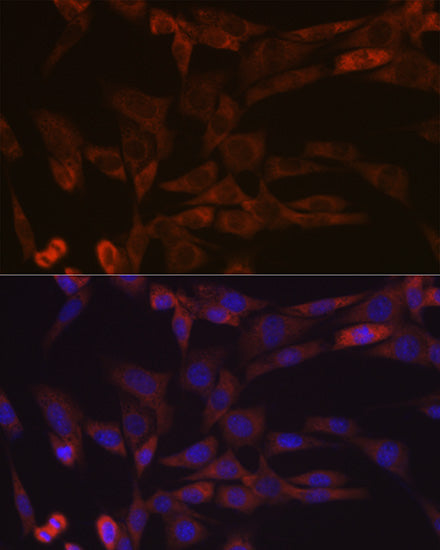 Inhibin beta A (INHBA) Rabbit mAb