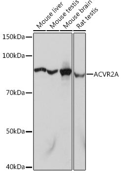 [KO Validated] ACVR2A Rabbit mAb