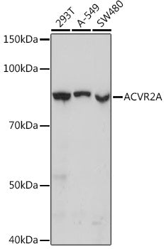 [KO Validated] ACVR2A Rabbit mAb
