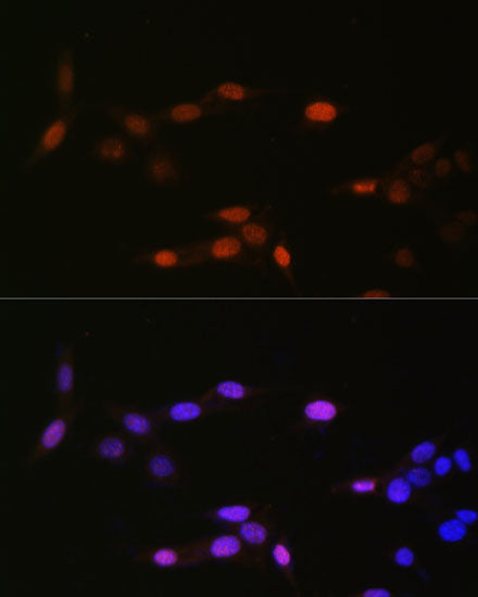 MonoMethyl-Histone H3-K14 Rabbit pAb
