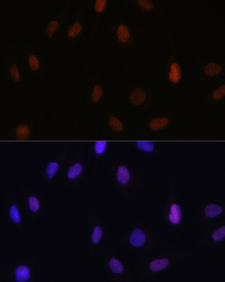 MonoMethyl-Histone H3-K14 Rabbit pAb