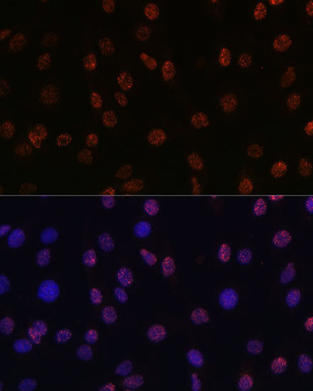 DiMethyl-Histone H3-K14 Rabbit pAb