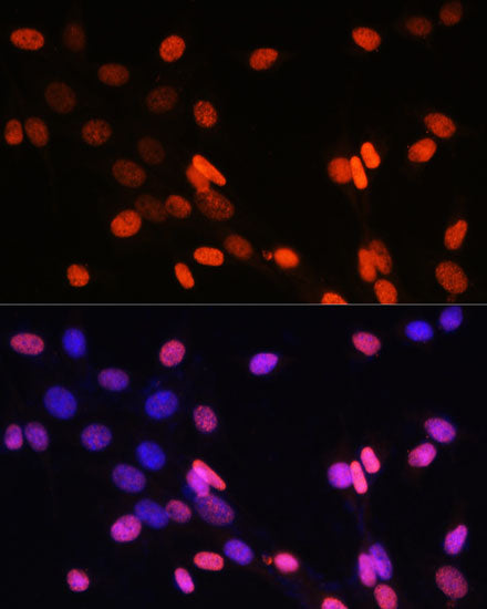 DiMethyl-Histone H3-K14 Rabbit pAb