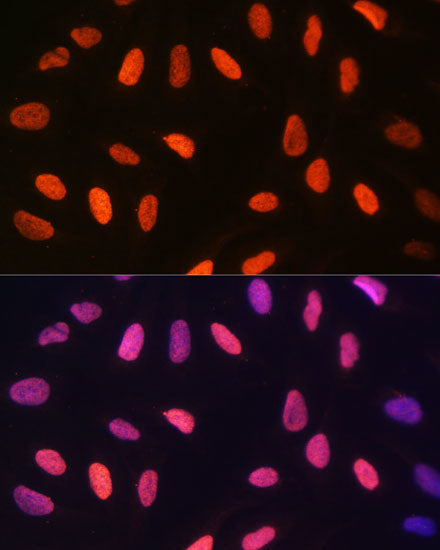DiMethyl-Histone H3-K14 Rabbit pAb