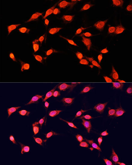 TriMethyl-Histone H3-K14 Rabbit pAb