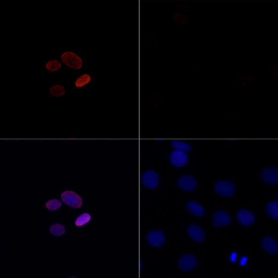 Acetyl-Histone H4-K16 Rabbit pAb