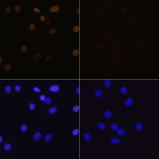 Acetyl-Histone H4-K16 Rabbit pAb