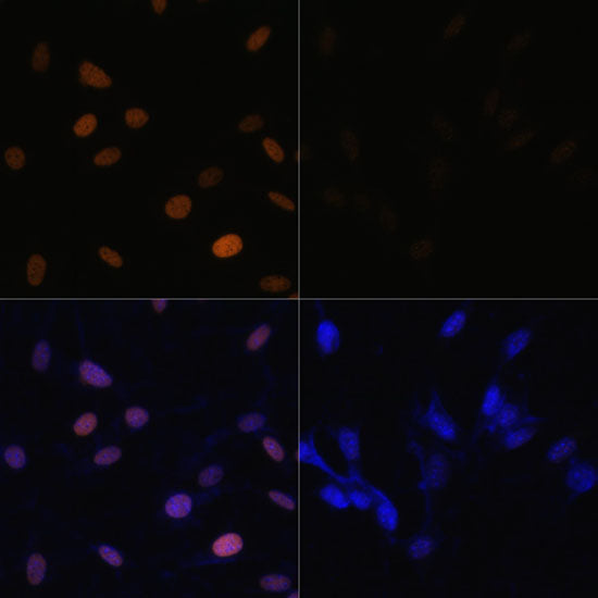 Acetyl-Histone H4-K16 Rabbit pAb
