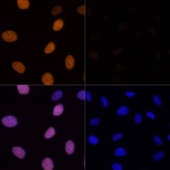 Acetyl-Histone H4-K16 Rabbit pAb