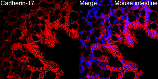 LI Cadherin/Cadherin-17 Rabbit mAb