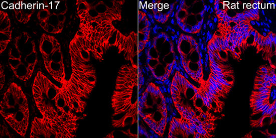 LI Cadherin/Cadherin-17 Rabbit mAb