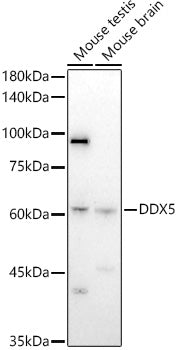 DDX5 Rabbit pAb
