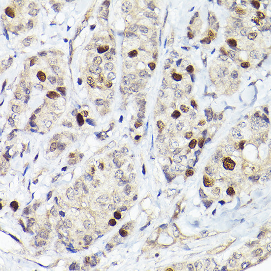RGAP1 Rabbit pAb