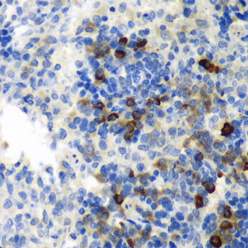 AIMP1 Rabbit pAb