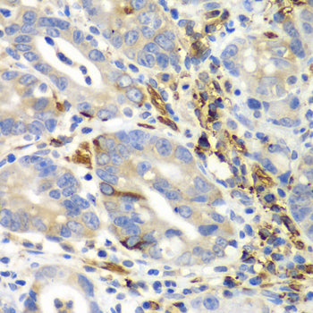AIMP1 Rabbit pAb