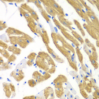 AIMP1 Rabbit pAb