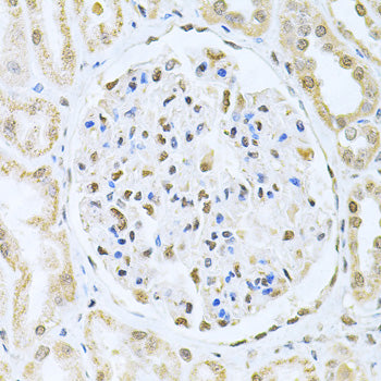 CBFB Rabbit pAb