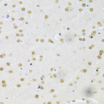 CBFB Rabbit pAb