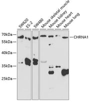 CHRNA1 Rabbit pAb