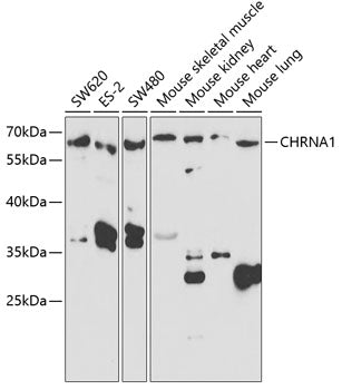 CHRNA1 Rabbit pAb