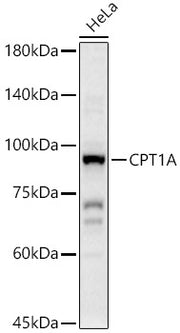 CPT1A Rabbit pAb