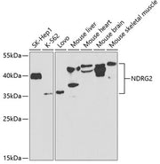 NDRG2 Rabbit pAb