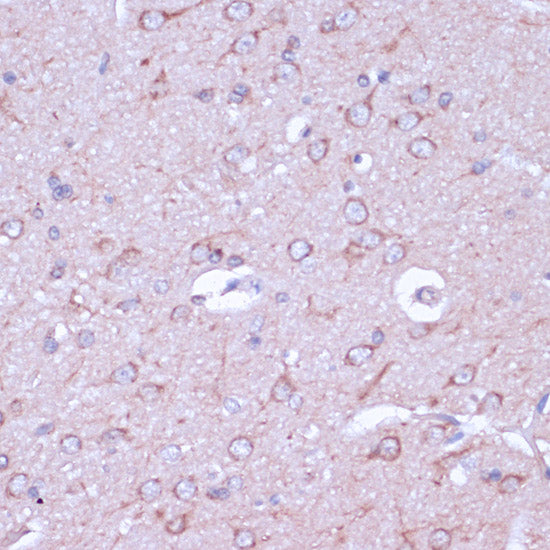 PKA C-beta (PRKACB) Rabbit pAb