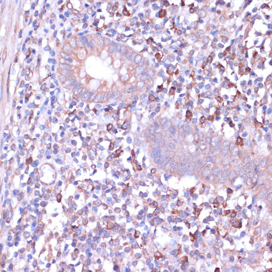 PKA C-beta (PRKACB) Rabbit pAb